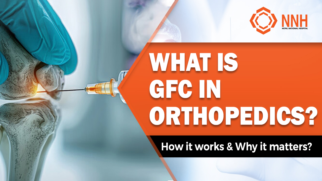 GFC in orthopedics