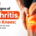Arthritis treatment in nepal